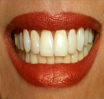 teeth-stem-cells